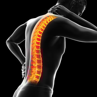 Axial-Spondyloarthritis-Market