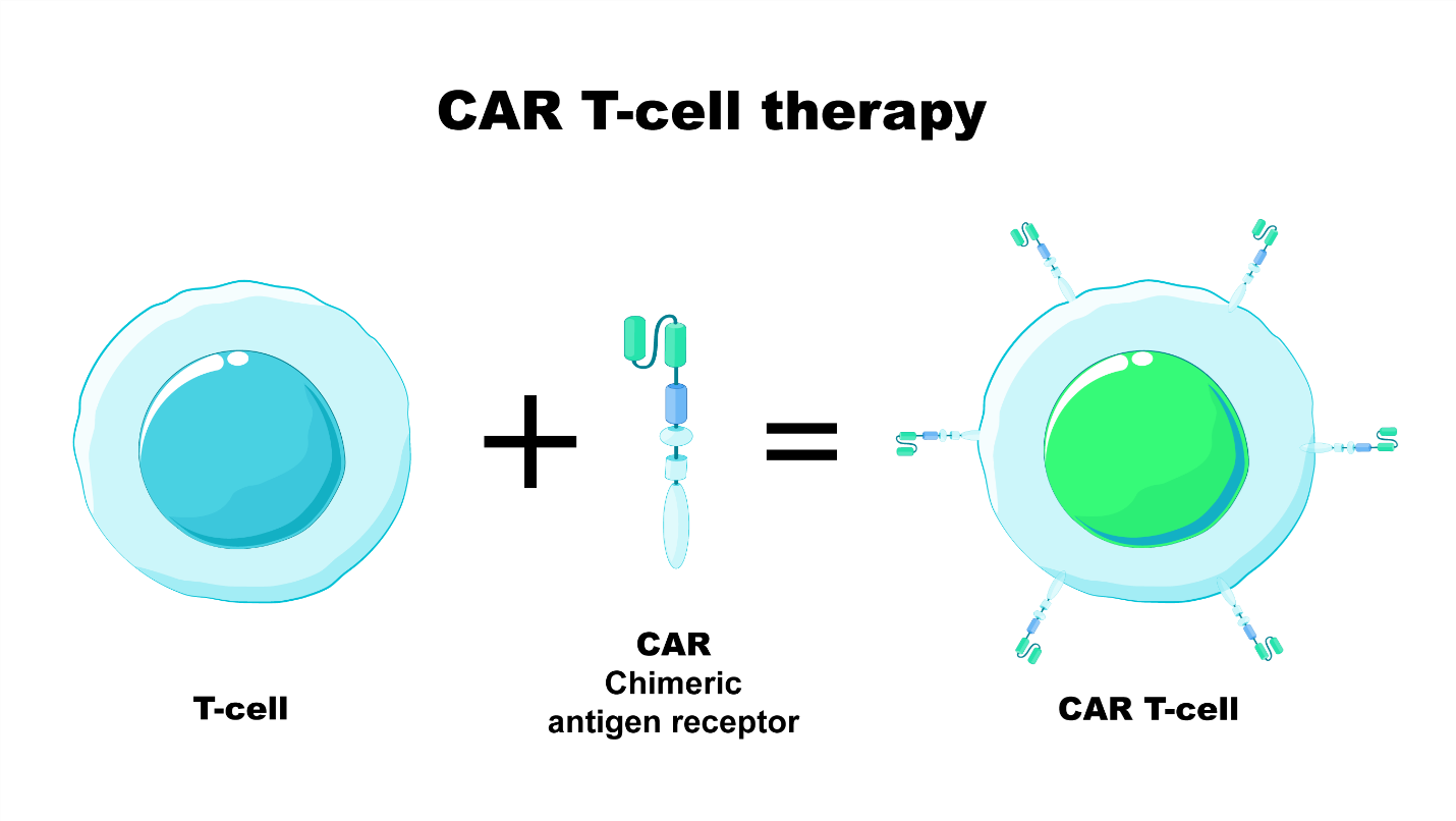 CAR T-Cells Therapy