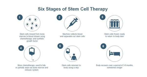 Figure 1 Stem cell therapy process