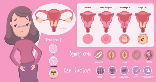 Symptoms of cervical cancer